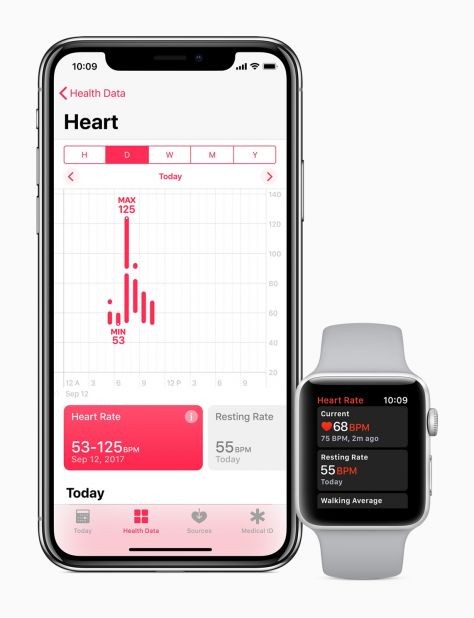 La montre Apple détecte avec précision le diabète